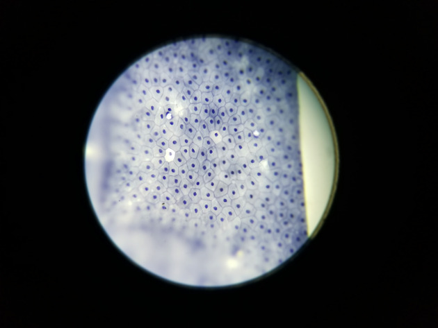 Simple Squamous Epithelium Slides - Simple Squamous Epithelium 03 100X